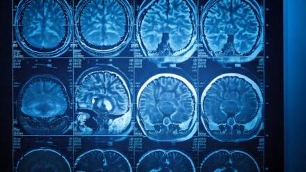 Neurology | US Medical Funding