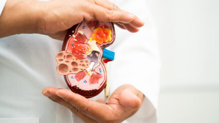 Nephrology Practice Owner Compensation: What Should You Consider? | US Medical Funding