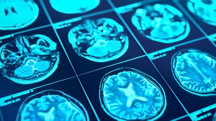 Neurology Practice Buy-In Financing | US Medical Funding
