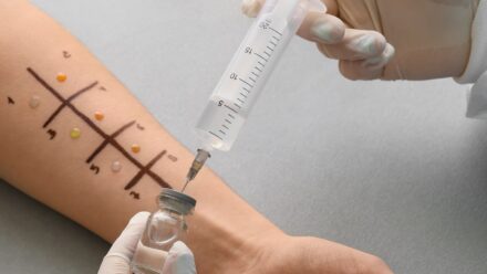 ENT Allergy Clinic: Financing Testing and Immunotherapy | US Medical Funding