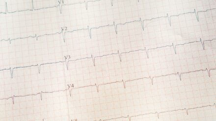 Cardiology Medicare Cuts: What Lenders Weigh | US Medical Funding