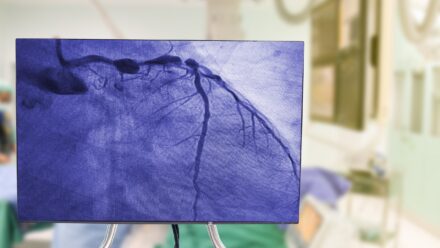 Cath Lab Certificate of Need: How It Affects Financing