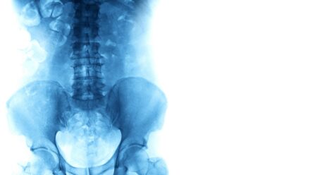 DEXA Scanner Financing for Endocrinology Practices | US Medical Funding