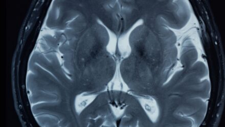 Cost to Start a Neurology Practice: A Planning Guide | US Medical Funding