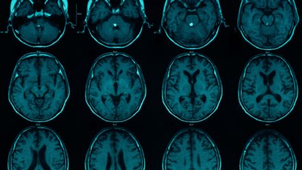 Neurology Practice Acquisition Loan Options | US Medical Funding