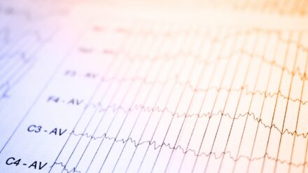 EEG and EMG Equipment Financing for Neurology Practices