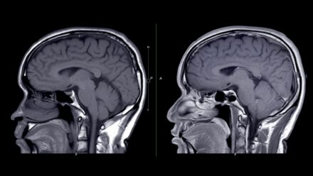 Neurology Private Equity: Selling Your Practice