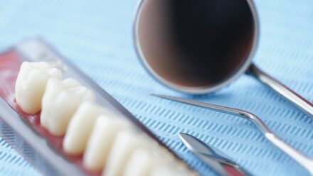 Full-Arch Implant Center Financing for Oral Surgeons | US Medical Funding