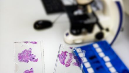 Digital Pathology Financing: Funding Whole-Slide Scanners | US Medical Funding